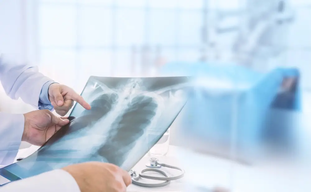 Ponencia médica del Hospital Angeles sobre diagnóstico y tratamiento de cáncer pulmonar con radiografías e imagen. 