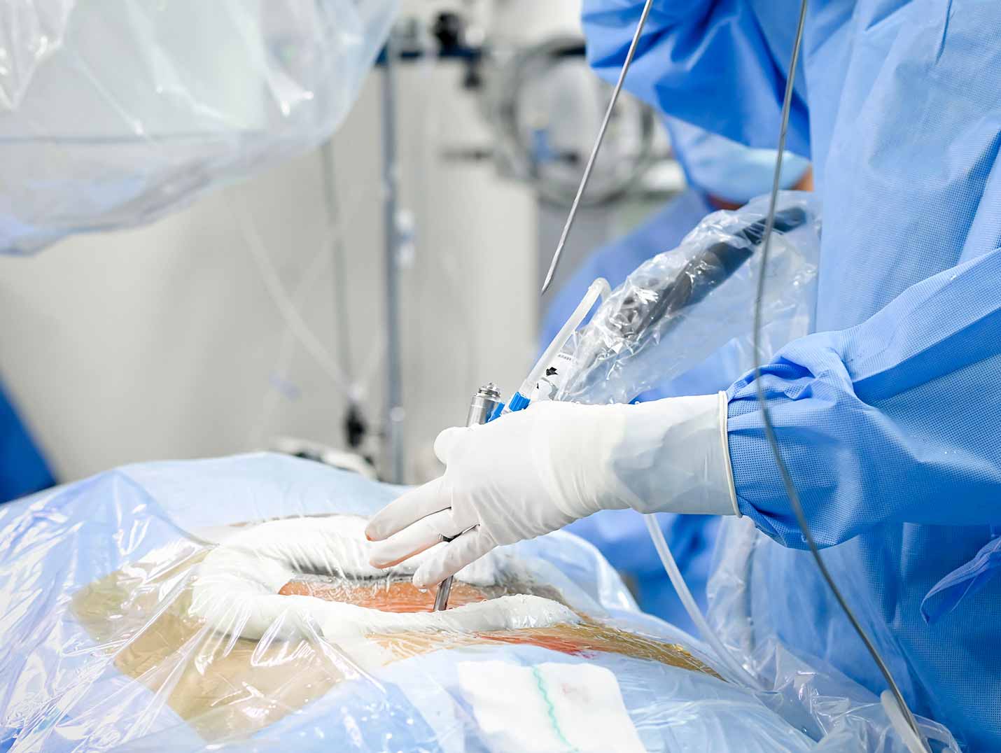 Médico dentro de quirófano con bata azul y guantes blancos realizando una cirugía de columna.