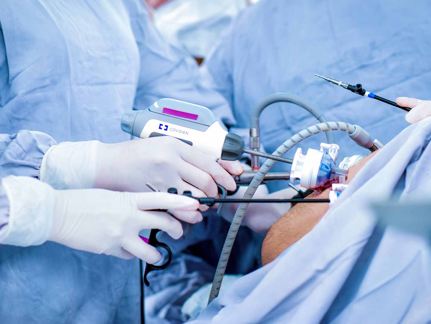 Médico con bata azul y guantes blancos sosteniendo e introduciendo unas pinzas en el estómago para un procedimiento bypass. 