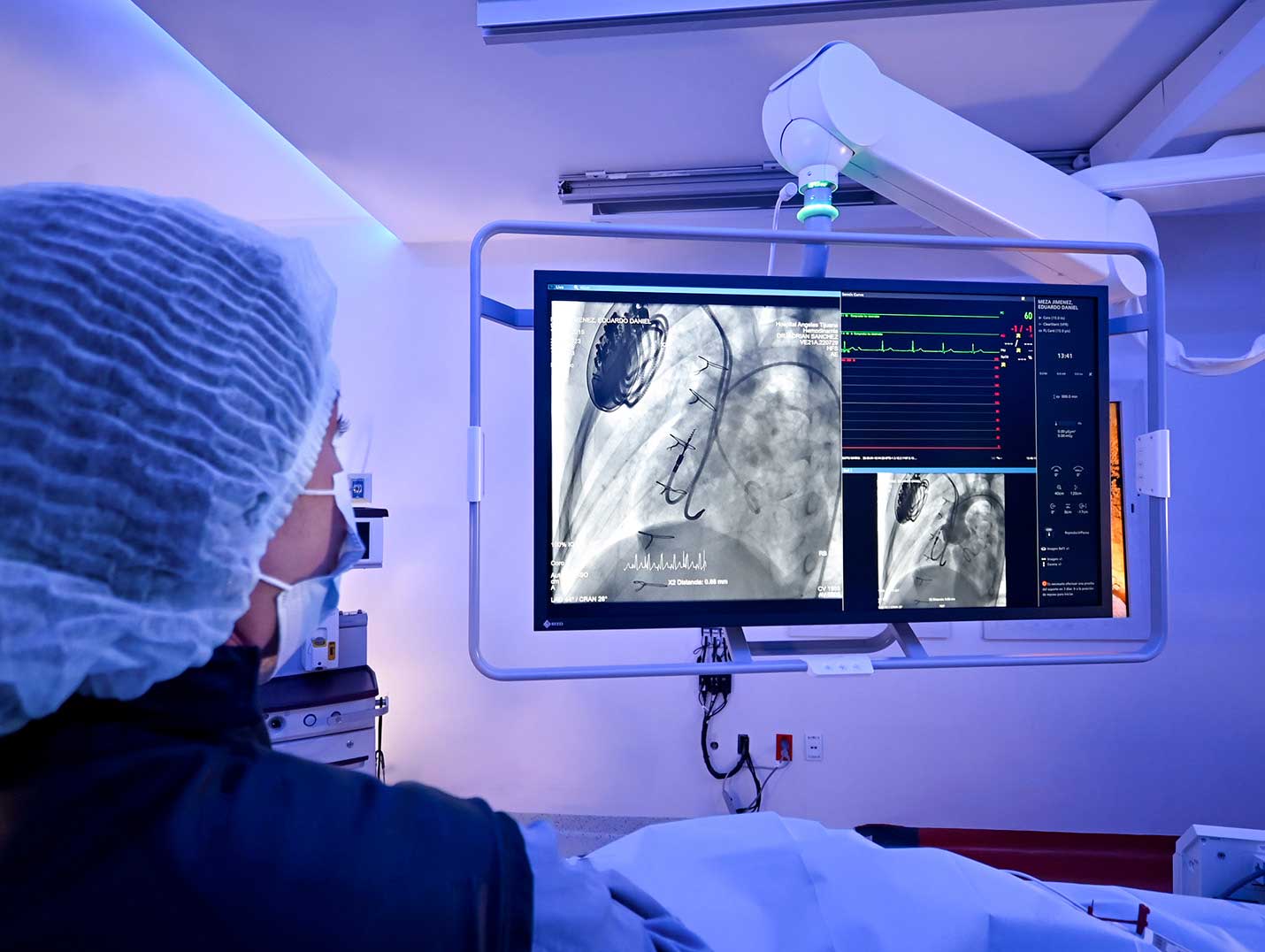 Doctora con cofia y cubrebocas mirando una radiografía de tórax en un monitor blanco, dentro de un quirófano