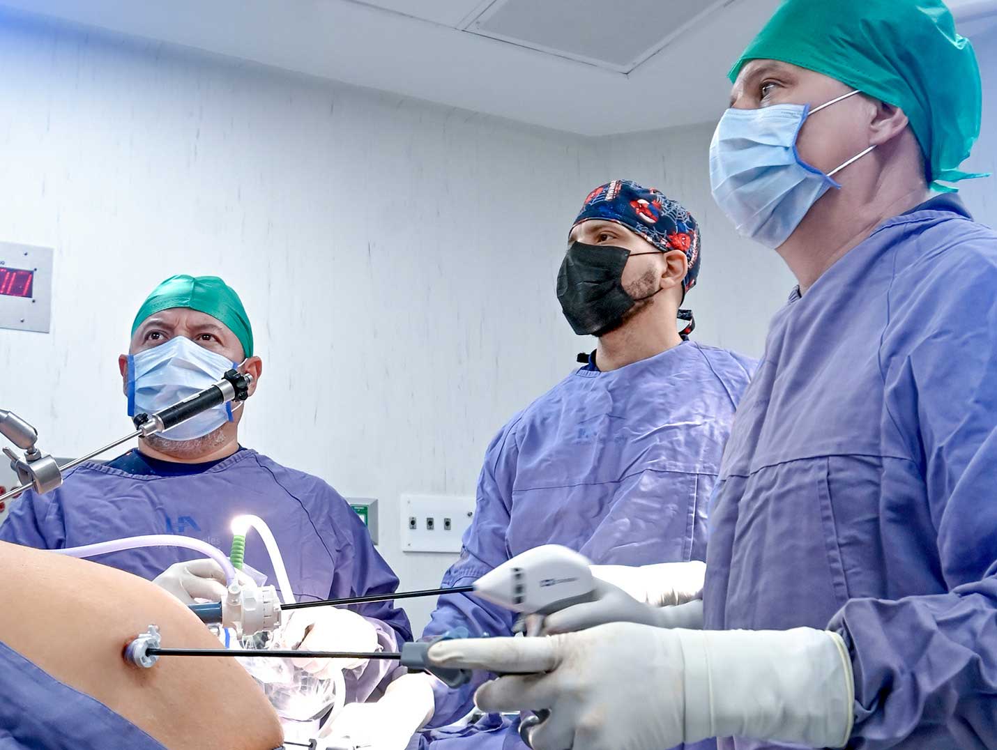 Médicos con vestimenta quirúrgica realizando una cirugía de obesidad y uno de ellos manipulando pinzas laparoscopicas.
