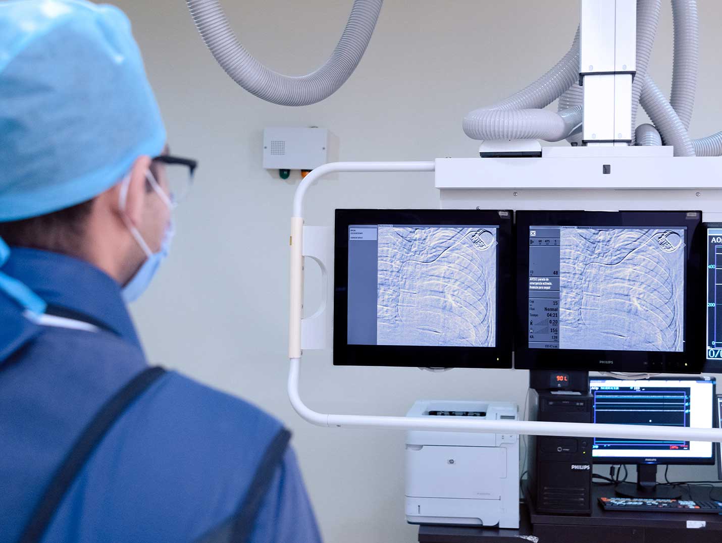 Médico en un quirófano observando detenidamente una radiografía de tórax en un monitor de color blanco