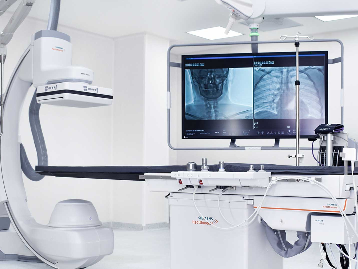 Equipo de hemodinamia con controles de operación y pantalla grande a un costado proyectando un estudio de cráneo y tórax
