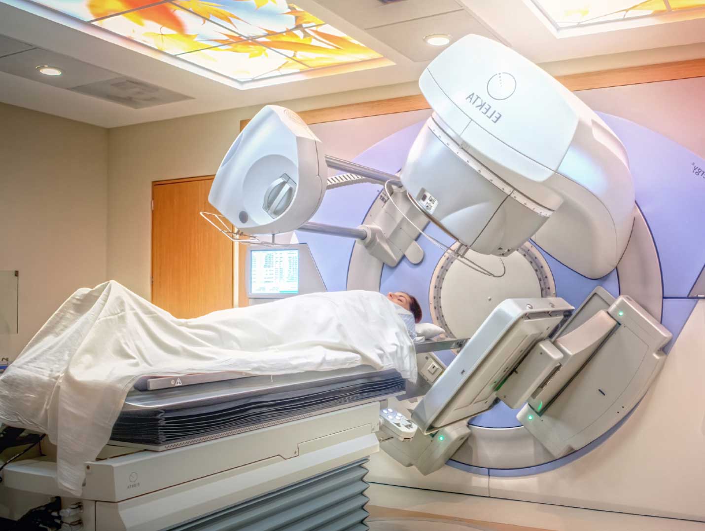 Paciente acostada y tapada con una sábana blanca en la camilla del acelerador lineal para recibir una sesión de radioterapia