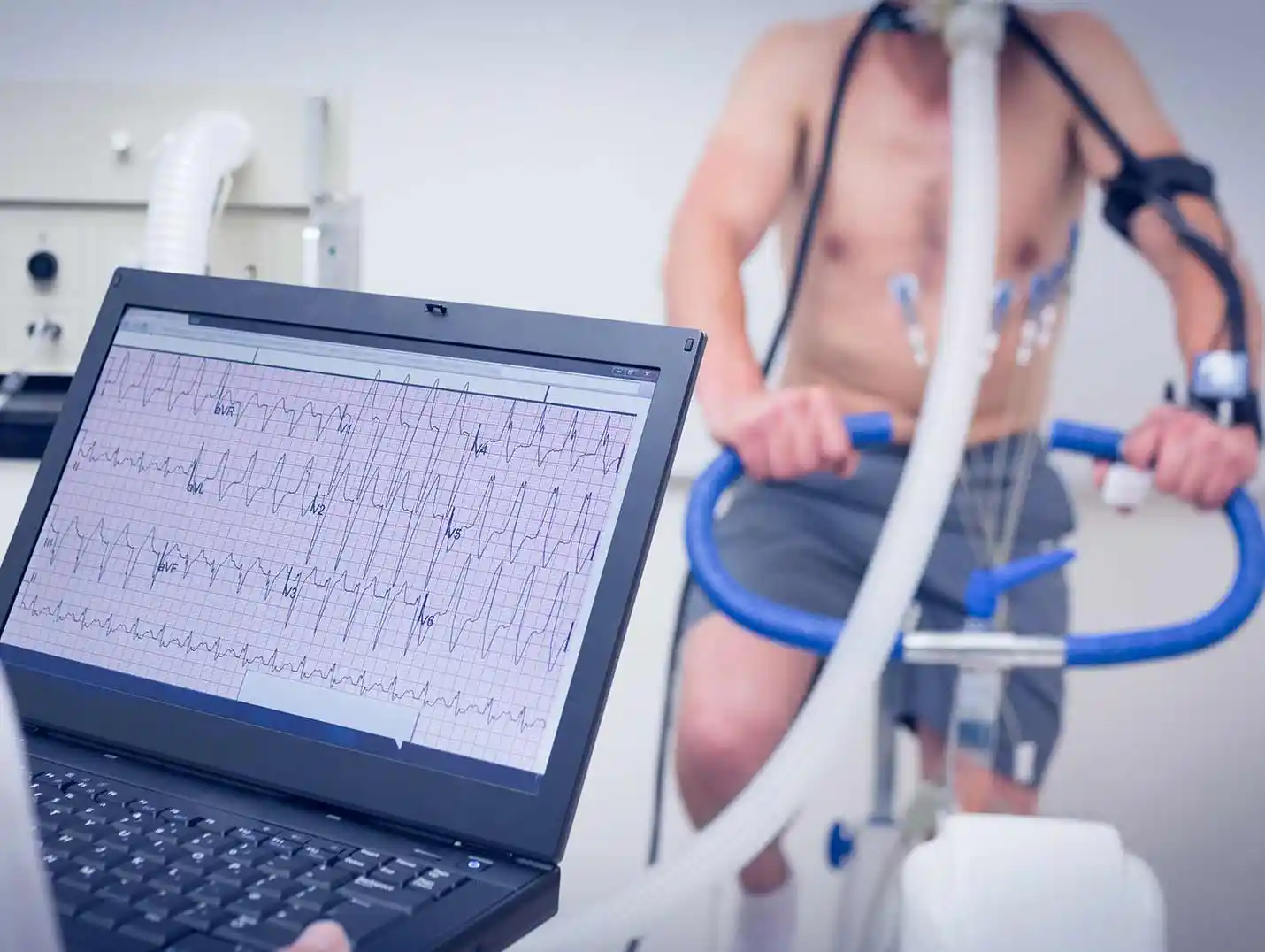 Paciente pedalenado y conectado a una bicicleta electrica mientras un doctor monitorea su frecuencia cardiaca en una pantalla.