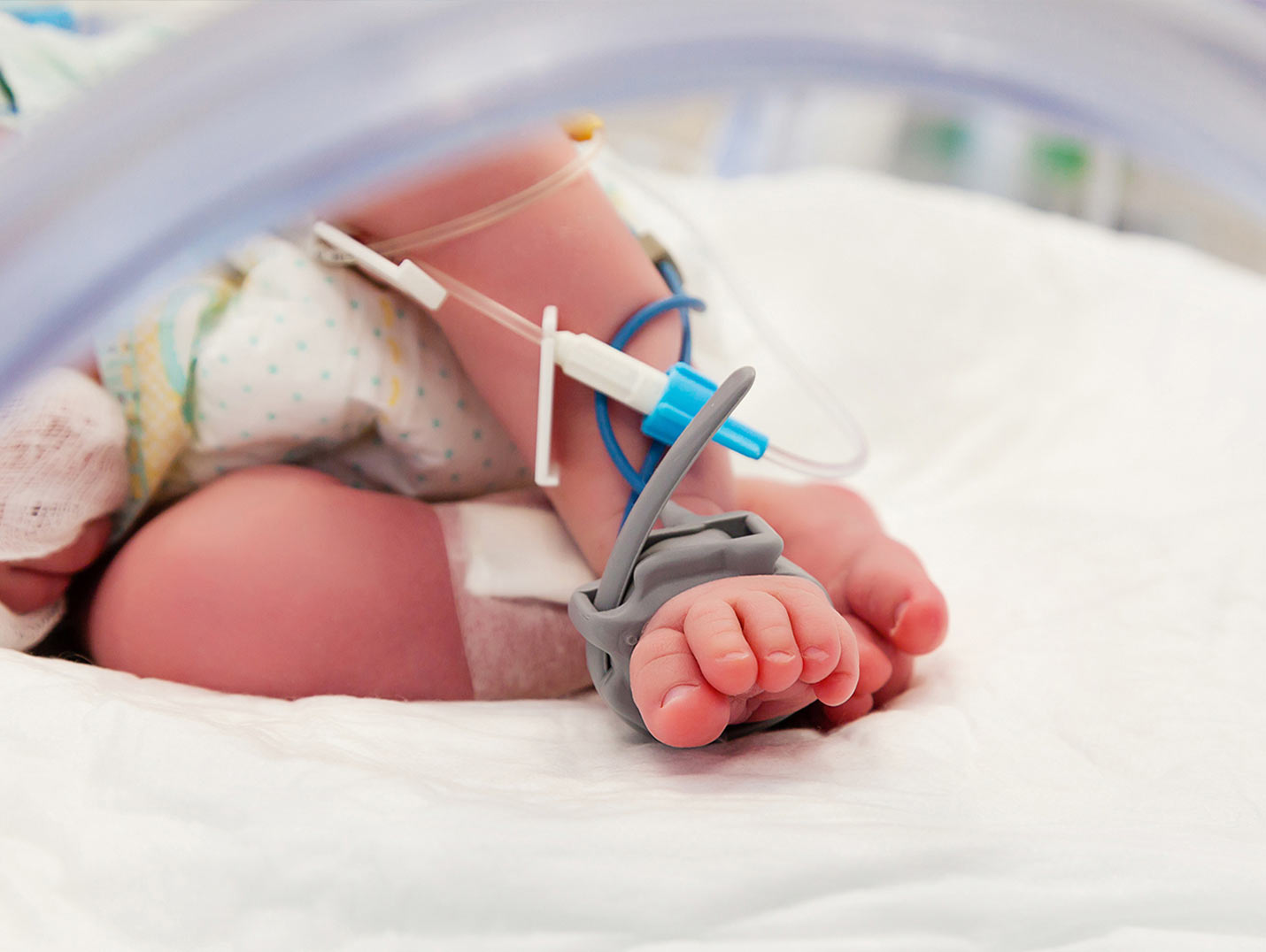 Pies de un bebé recién nacido con un oxímetro neonatal de color gris. El bebé está dentro de una incubadora