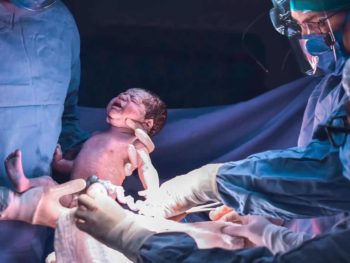 Tres médicos con pijamas azules para cirugía y guantes blancos. Uno de ellos carga a un bebé recién nacido y otro corta el cordón umbilical